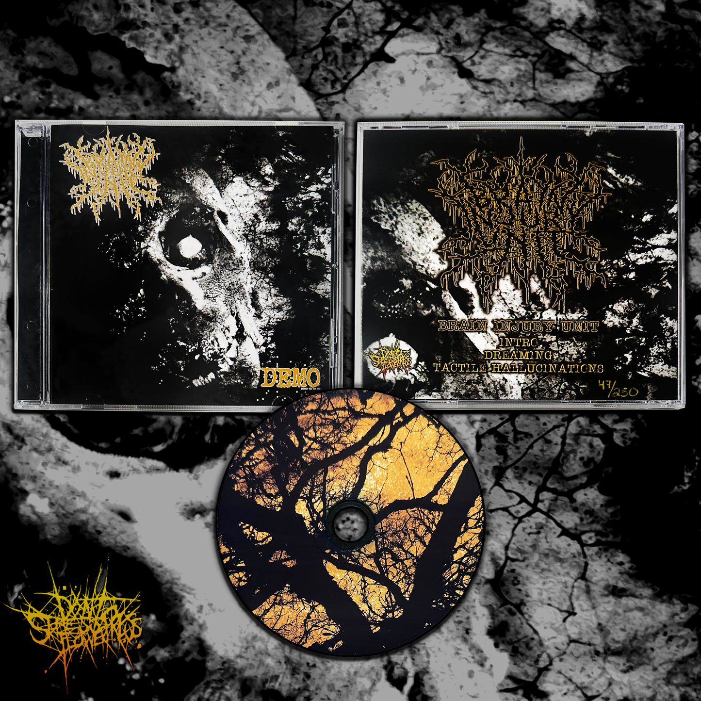 Brain Injury Unit - Demo